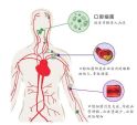 预防心血管病应从口腔健康做起！