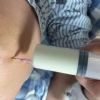 痛风患者注意五点过好夏天