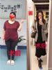 体重两百斤，胖到无法受孕，深圳女子手术后减80斤，并成功怀孕