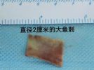 男子吞了一根鱼刺，反而救了他一命！这个故事有点离奇……