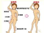 吸脂手术选择不当风险和后遗症有哪些？